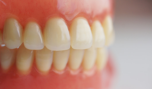 Complete dentures