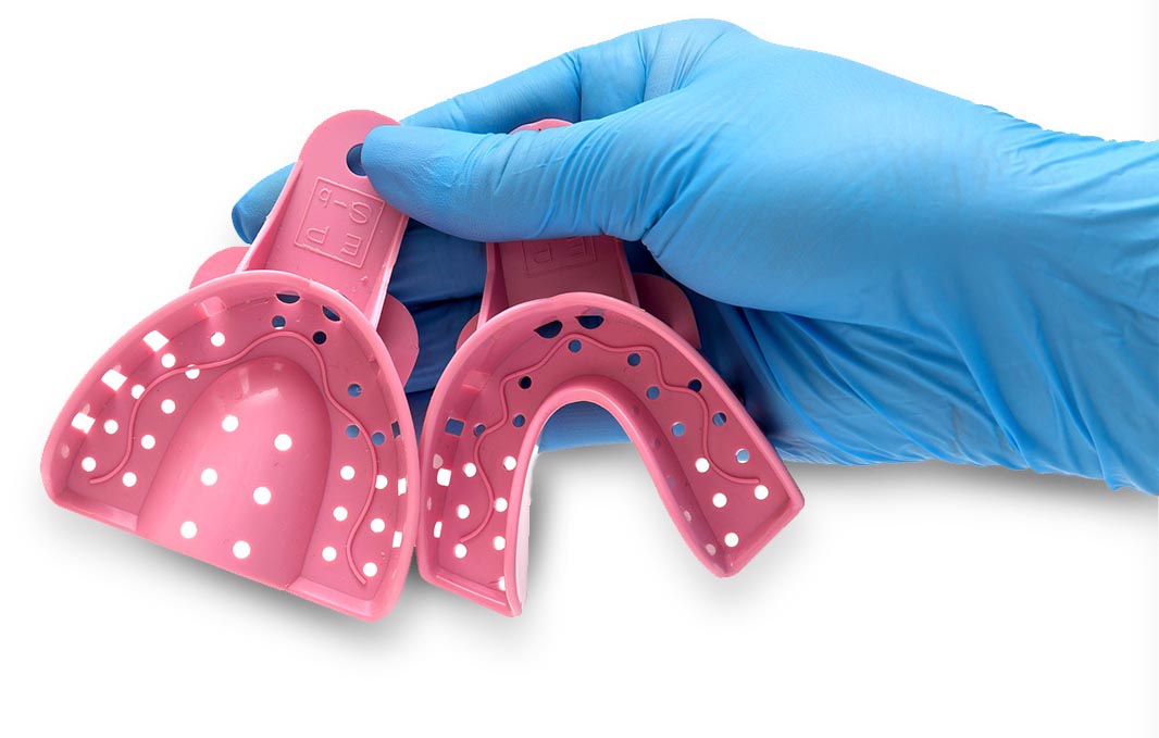 immediate dentures molding casts