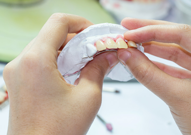 Dentures being relined